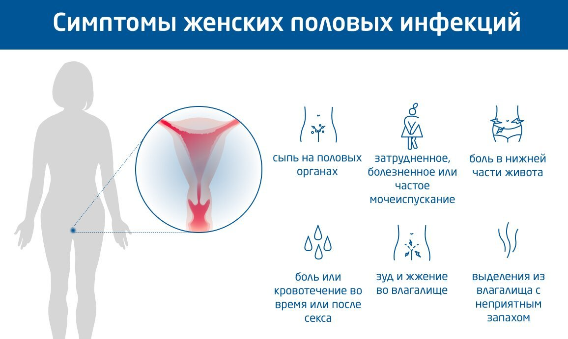 Симптомы женских половых инфекций