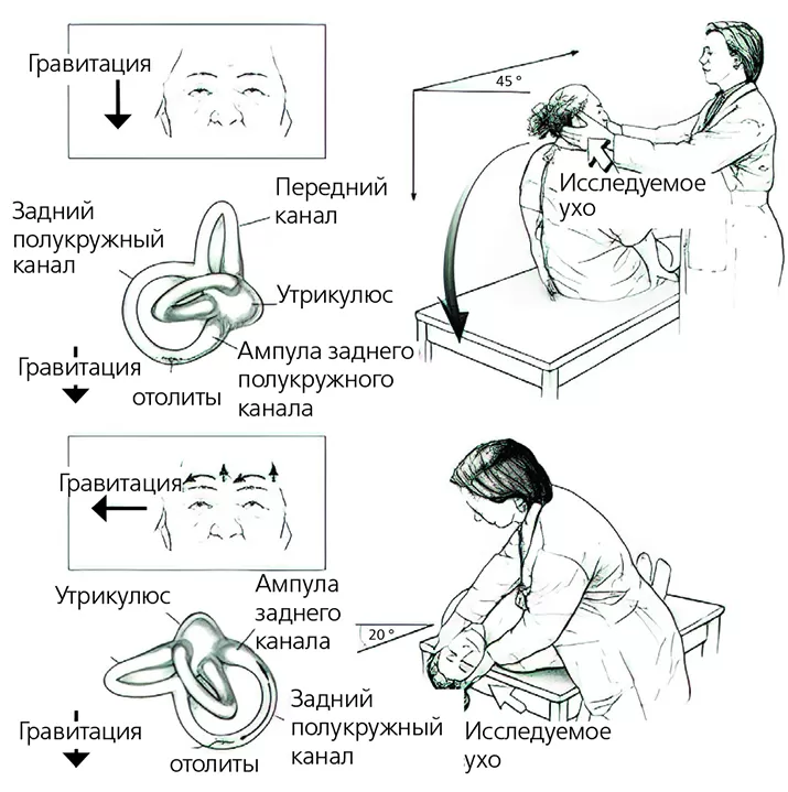 диагностическая проба Дикса